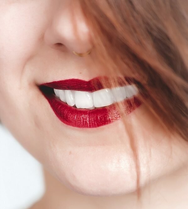Teeth Whitening + Cosmetic Dentistry at NorthView Dental, London ON
